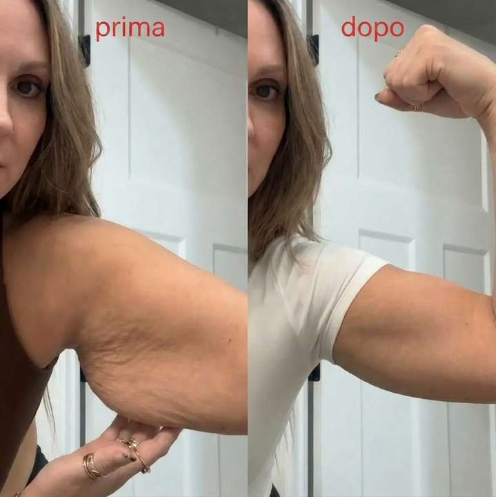 Evored™ Body Sculpting – Il Segreto per una Silhouette Definita